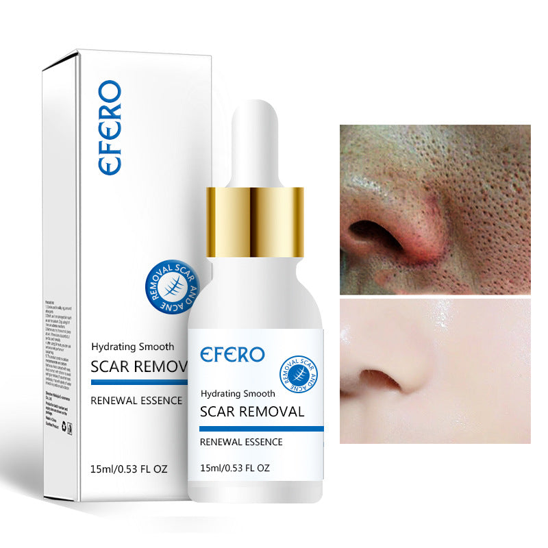 Acne Repair Serum for Scars and Wrinkles, Firming