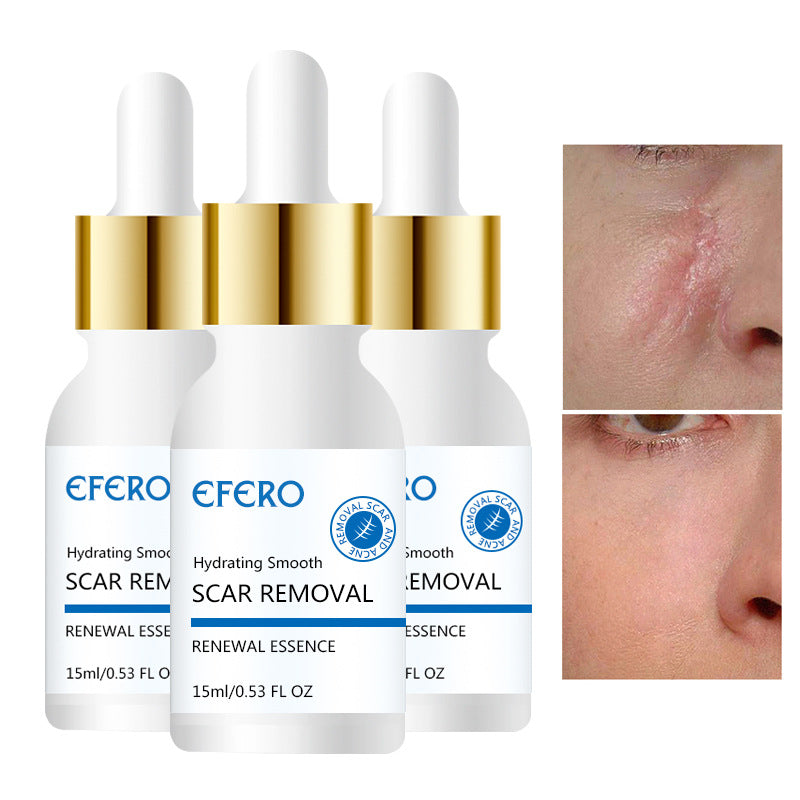 Acne Repair Serum for Scars and Wrinkles, Firming