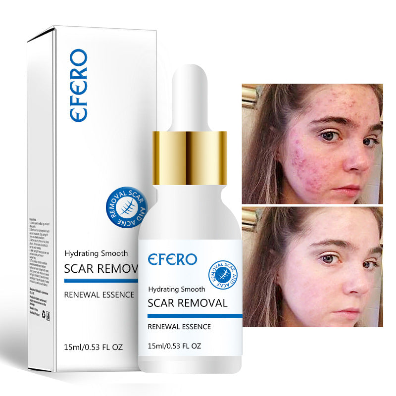 Acne Repair Serum for Scars and Wrinkles, Firming