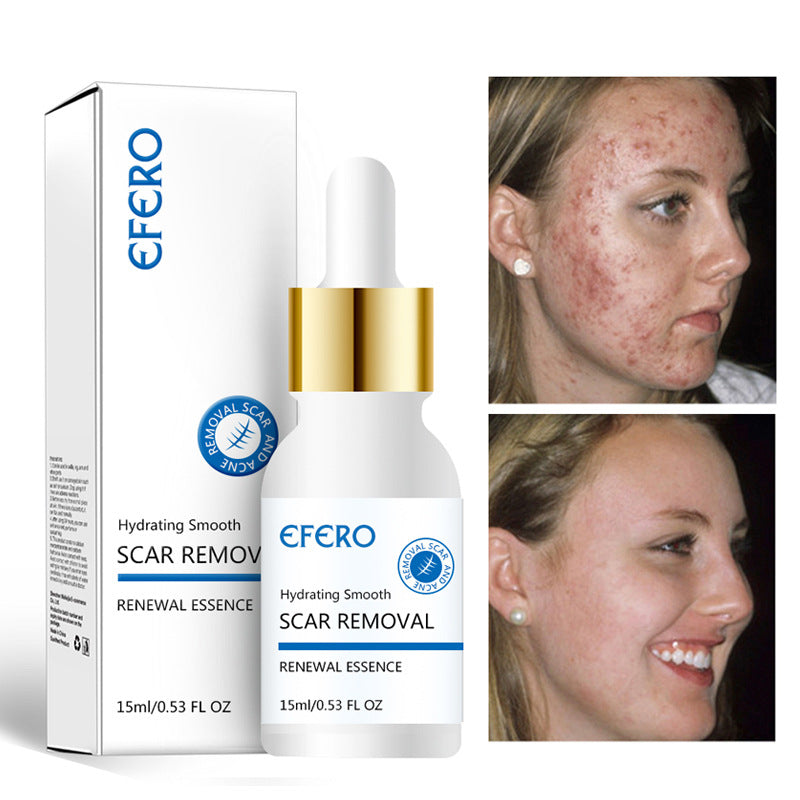 Acne Repair Serum for Scars and Wrinkles, Firming